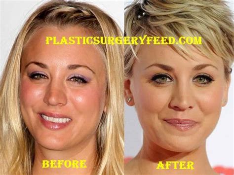 Kaley Cuoco | Nose job, Plastic surgery, Feel better