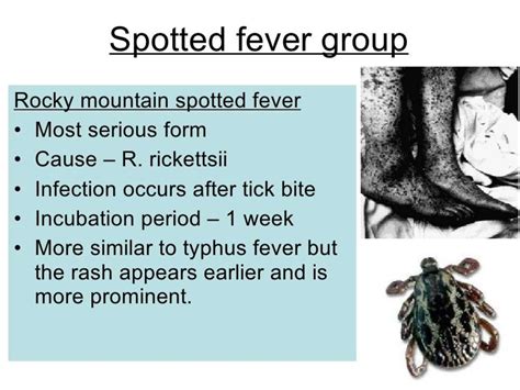 Rickettsial infection - презентация онлайн