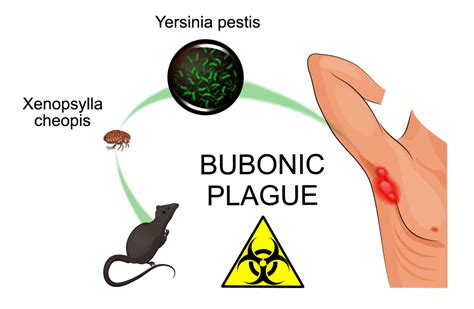 Rat Fleas - Xenopsylla Cheopis or Nosopsyllus Fasciatus Bites - FLEABITES