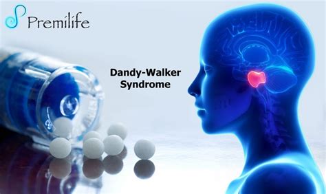 Dandy-Walker Syndrome | Premilife - Homeopathic Remedies