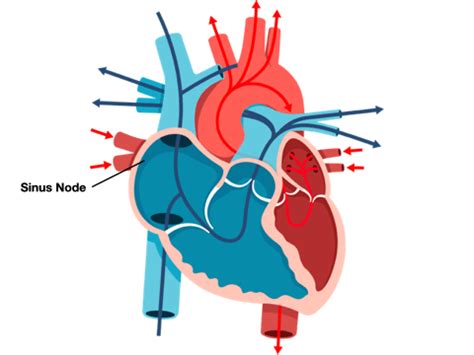 Atrial Fibrillation: What Happened In An Afib (AF)? - DoctorOnCall