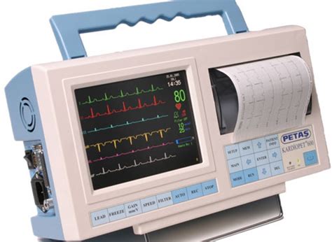 Fungsi Elektrokardiogram (EKG) Pada Alat Kesehatan - FUNGSI ALAT