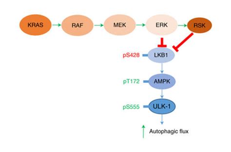 Hitting an Elusive Target in Pancreatic Cancer - NCI