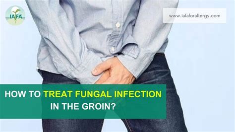 How to Treat Fungal Infection in the Groin?