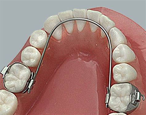 Treatment Options - The Orthodontic Centres