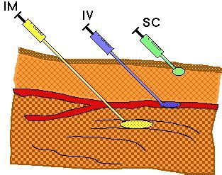 mynsgnotes.blogspot.com: INJECTION IV