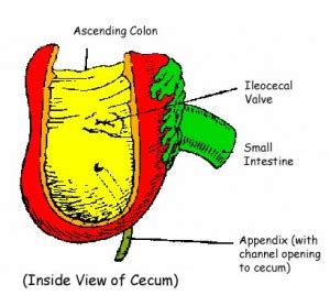 Appendix Pain – Symptoms, Causes, Location and Treatment