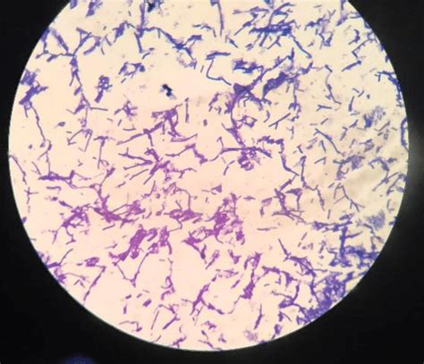 Result of Gram staining under light microscope with magnification... | Download Scientific Diagram