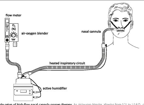 High Flow Nasal Cannula Indications : PPT - Nasal Cannula Intermittent ...