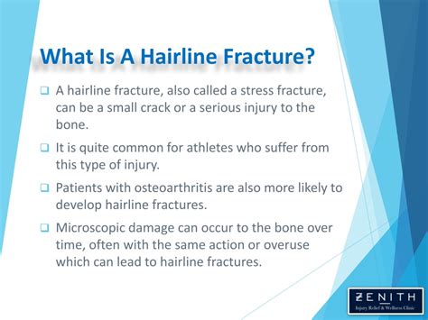 PPT - Hairline Fracture - Causes, Symptoms and Treatment PowerPoint Presentation - ID:11752160