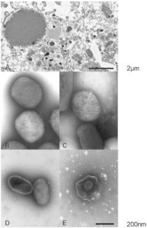 Orthopox Viruses: Infections in Humans. - Abstract - Europe PMC