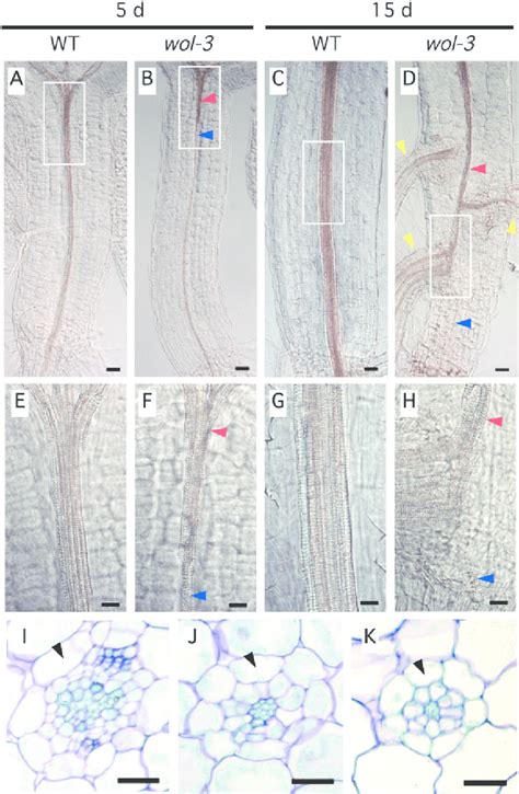 Vascular development in hypocotyls of the wol-3 mutant. (A–H ...