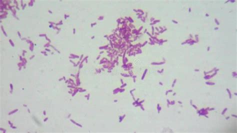 E Coli Gram Stain 100x