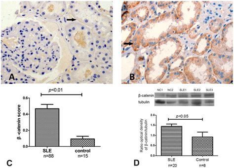 The protein levels of β-catenin in LN and control kidney tissues. The... | Download Scientific ...