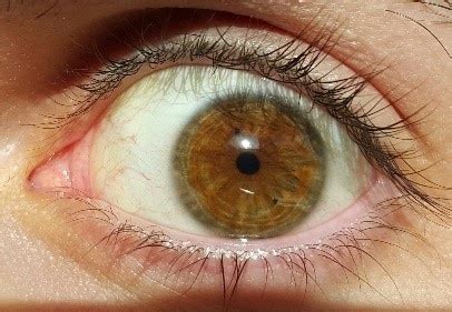 Why do some adults have small pupils in one or both eyes?