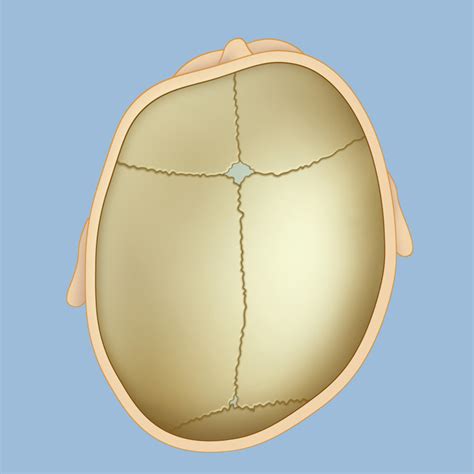 Deformational Plagiocephaly | Neurological Surgery