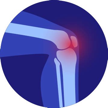 Knee Pain Treatment | Knee Pain Treatment Plan | Knee Pain Therapy