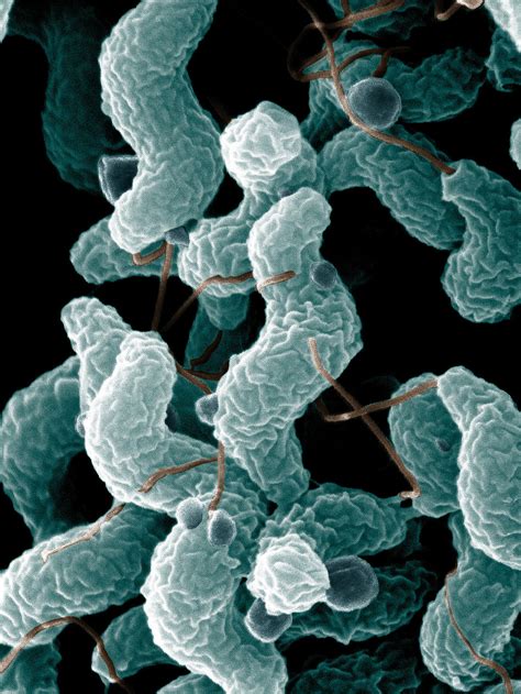 Bacteria | Free Stock Photo | Campylobacter bacteria as seen from an ...