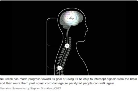 Neuralink’s Brain Chip Plan: Help the Blind See and the Paralyzed Walk ...