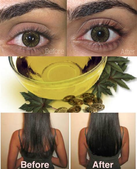 The Only Natural Ingredient You Need For Hair Regrowth | Top Health Remedies | Natural hair ...