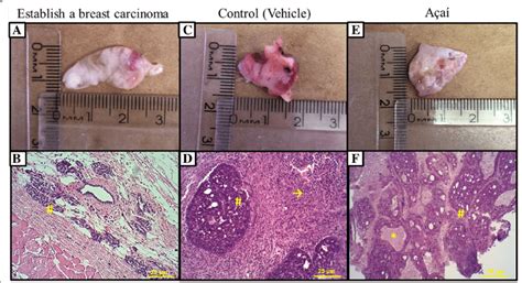 Establishment of the experimental model of breast cancer and treatment... | Download Scientific ...