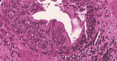 Glandular Epithelium - Basic Histology