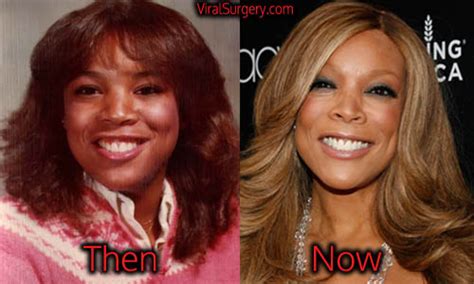 Wendy Williams Plastic Surgery, Before and After Liposuction Pictures