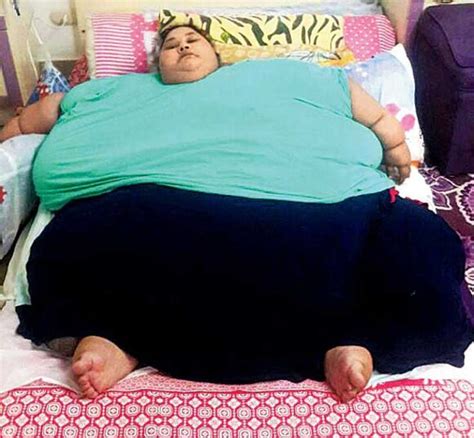 Worlds Heaviest Woman Eman Ahmed Loses Over 100 kg In 3 Weeks Through Diet And Physiotherapy