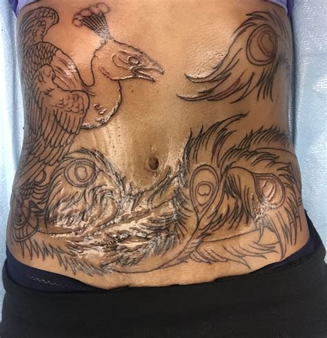 Outline done. Tummy tuck scar cover up! #tummytuck #pheonix #lovemyink #scarart | Body art ...