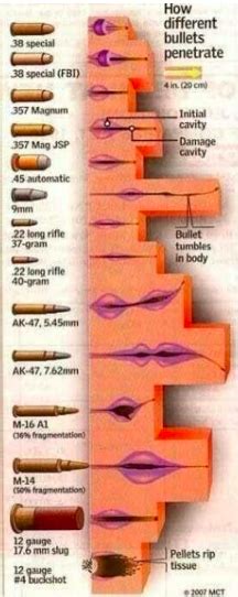 Wounds By Firearms - 2nd Shot: Explanation of Caliber and Wound Pics ...