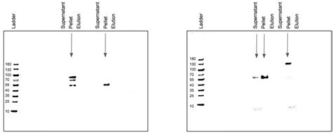 Why are my Western Blot antibodies binding to some lanes and not others?