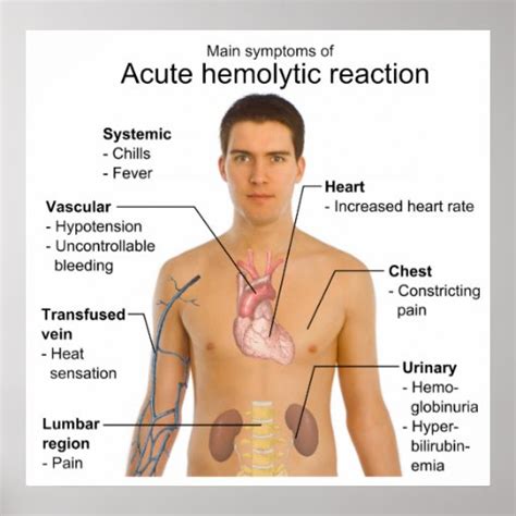 Symptoms of Acute Hemolytic Transfusion Reaction Poster | Zazzle