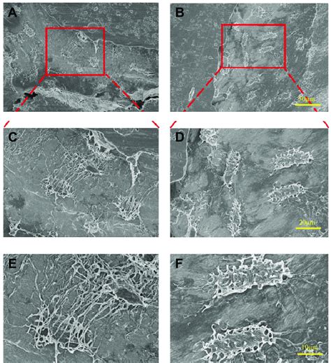 Defective structure and organization of osteocyte lacuno-canalicular... | Download Scientific ...