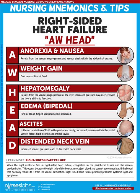 Cardiovascular Care Nursing Mnemonics and Tips - Nurseslabs | Nursing ...