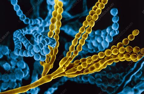 Penicillium fungal spores, SEM - Stock Image B250/0983 - Science Photo ...