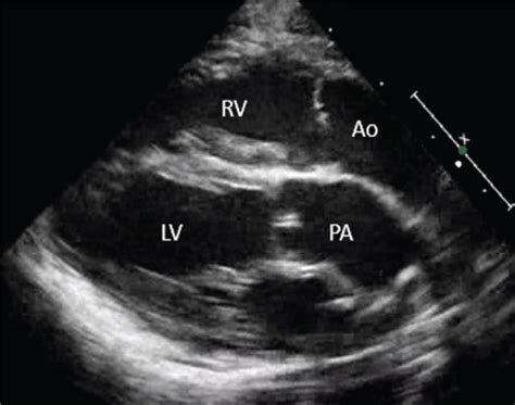 Preoperative Diagnostic Evaluation | Thoracic Key