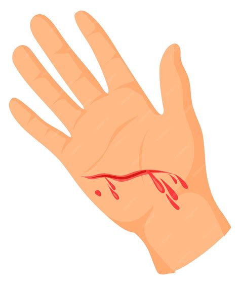 Premium Vector | Hand with bleeding cut Palm wound Injury icon