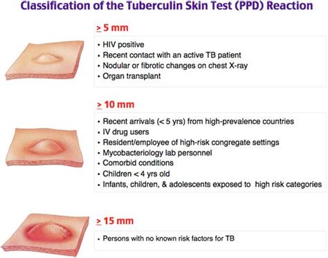 Ppd Test Results Form