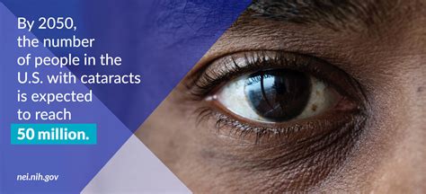 Eye Surgery: From Cataract to LASIK – Types, Recovery, and Risks | Made ...