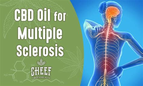 CBD for Multiple Sclerosis Pain - [The Full Truth] | Cheef Botanicals