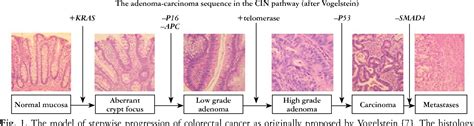 [PDF] Molecular pathology of colorectal cancer. | Semantic Scholar