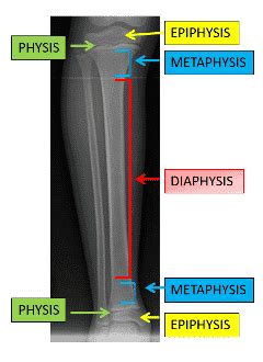 LLRS Key Surgical Technique: Epiphysiodesis - LLRS