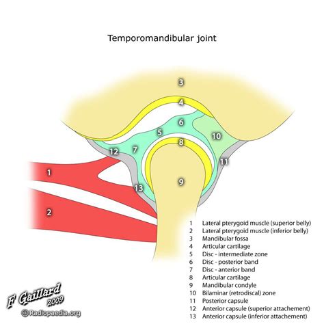 7. Temporomandibular joint | RANZCRPart1 Wiki | FANDOM powered by Wikia