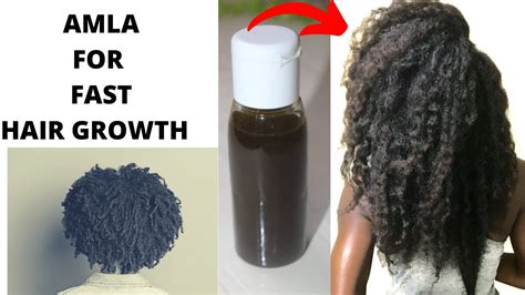 How to Make Amla Oil For Faster hair Growth and Prevent Hair Loss | DIY ...