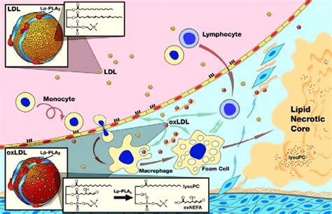 Schematic representation of the proposed pro-atherogenic mechanism of... | Download Scientific ...