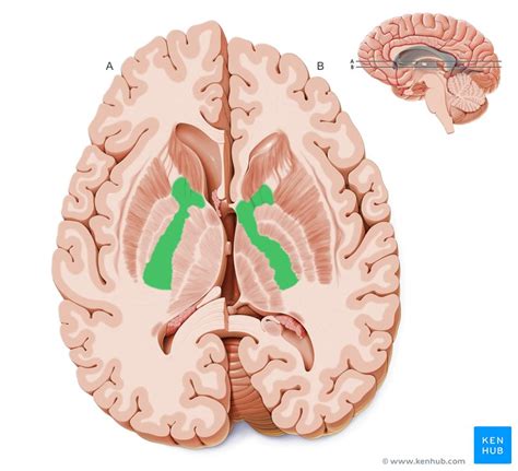 Horizontal sections of the brain: Anatomy | Kenhub