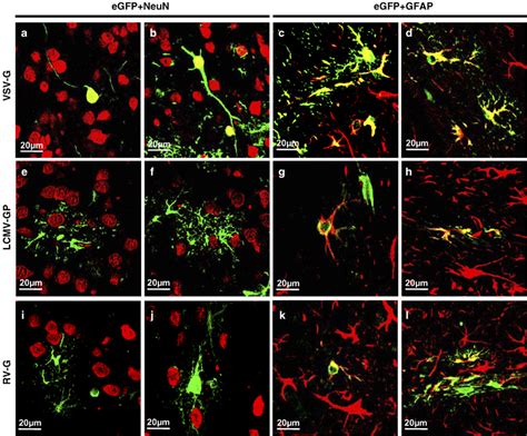 Double immunohistochemical staining of representative brain sections ...