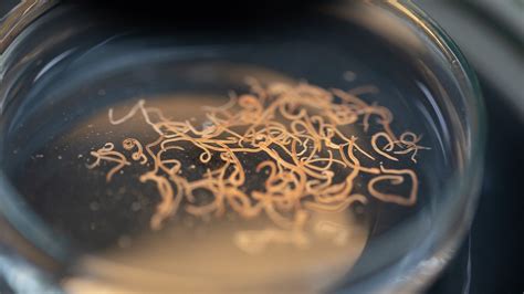 What Do Roundworms Look Like In Human Stool - Infoupdate.org