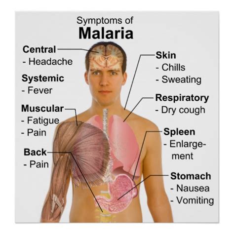 Malaria Fever In Children: Symptoms, Treatment, And Prevention In The ...