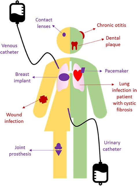 Dangerous Slimes: How Bacterial Biofilms Make You Sick and How to Combat Them · Frontiers for ...